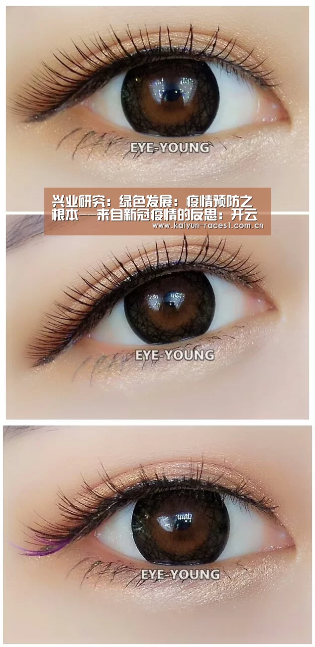 兴业研究:绿色发展:疫情预防之根本--来自新冠疫情的反思:开云官网(图3) 开云官网